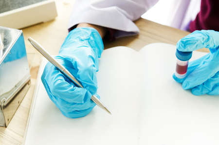 A pipette dropping sample into a test tube,abstract science backgroundの写真素材