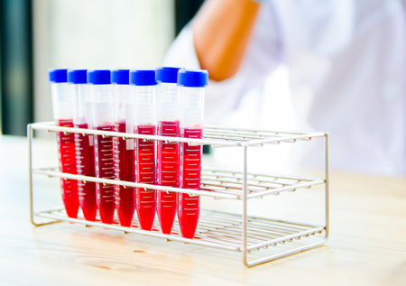 Vacutainer or test tube in lab on tableの写真素材