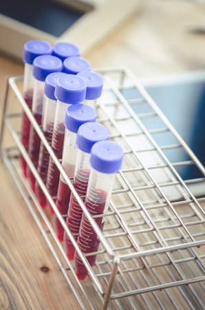 Vacutainer or test tube in lab on tableの写真素材