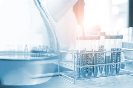 Vacutainer or test tube in lab on tableの写真素材