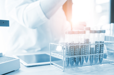 Vacutainer or test tube in lab on tableの写真素材