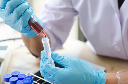 A pipette dropping sample into a test tube,abstract science backgroundの写真素材