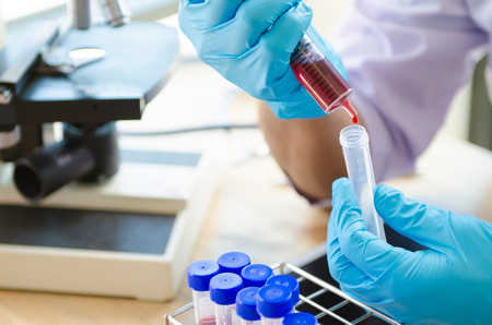 Vacutainer or test tube in lab on tableの写真素材