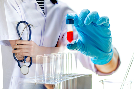 Medical physician doctor woman over laboratory tube blood test and glasswareの写真素材