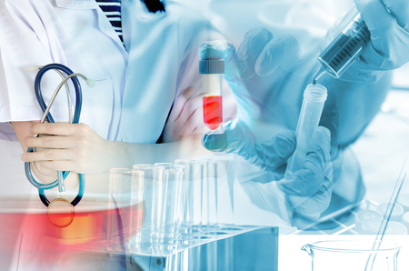 Medical physician doctor woman over laboratory tube blood test and glasswareの写真素材