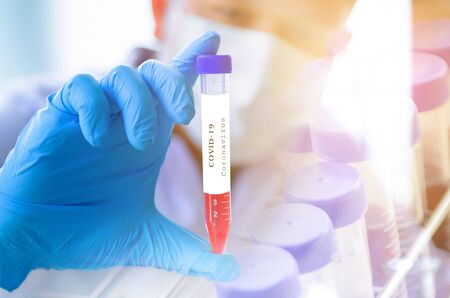 Coronavirus 2019-nCoV Blood Sample.    lab for vaccine .の写真素材