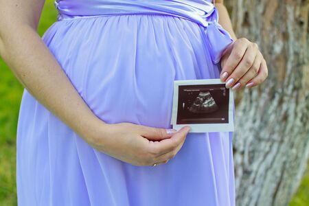 Pregnant woman with an ultrasoundの写真素材