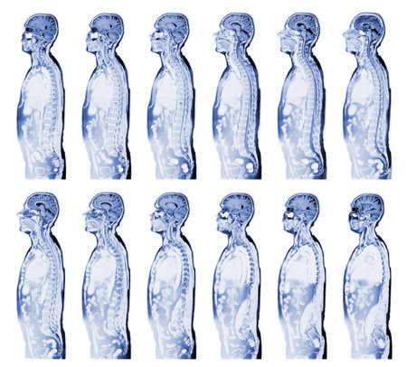 Complete real MRI scan the upper part of the human bodyの写真素材