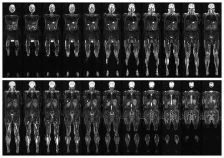 Complete real MRI scan of the human body, from the front and backの写真素材