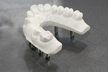 Dental casting gypsum plaster model of teethの写真素材