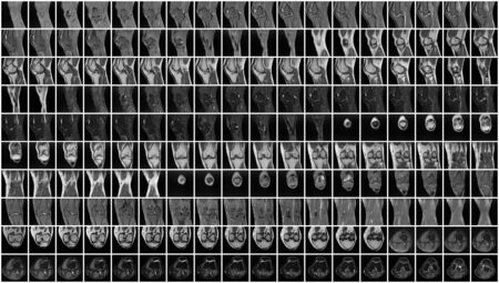 Complete Magnetic resonance imaging (MRI) of leftt kneeの写真素材