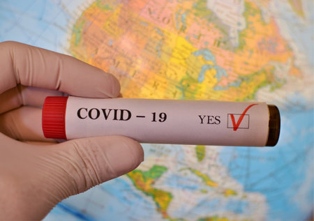 Corona Virus Vial over North America
