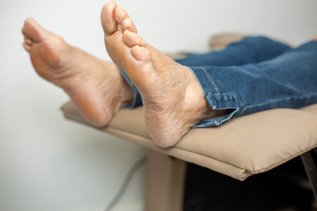 Feet of an elderly woman with dry skin before the procedure of anti-aging pedicure for the elderly....