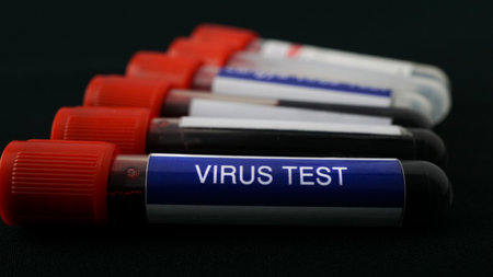 Blood samples for virus test on a black background, conceptual image. Virus test with blood sample in tube test. On white background. Concept for virus test with real blood.の写真素材