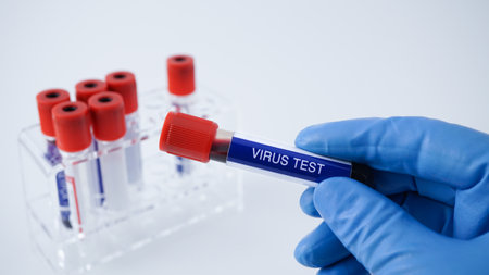 <p>Blood sample for virus test in a test tube with blue gloves. Concept science background. Tube in blue glove. Red lid on tube. Hand hold virus tube test with blood.</p>の写真素材
