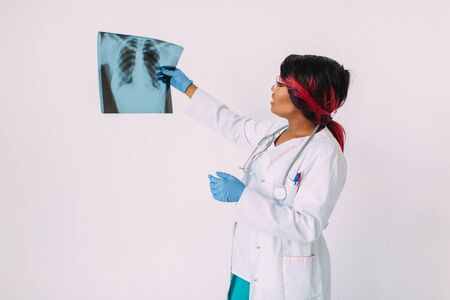 Young African American woman doctor in medical wear looking at x-ray imageの写真素材
