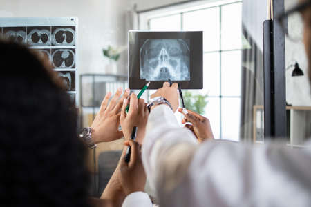 Back view of hands of medical multiethnic team, pointing at x-ray image scan of patients head, discussing diagnosis and treatment. Glass board with x-ray and MRI scansの写真素材