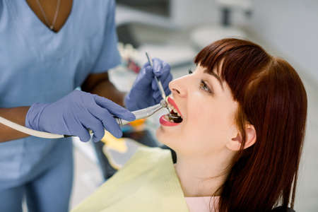 Close-up side view face portrait of pretty young Caucasian woman patient having dental treatment in dentist office. Hands of african dentist in gloves holding dental tools.の写真素材