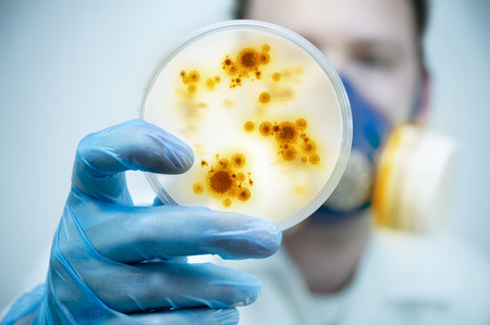 Science and Lab Research.A scientist holding a Petri Dish with Virus and bacteria cells.の写真素材