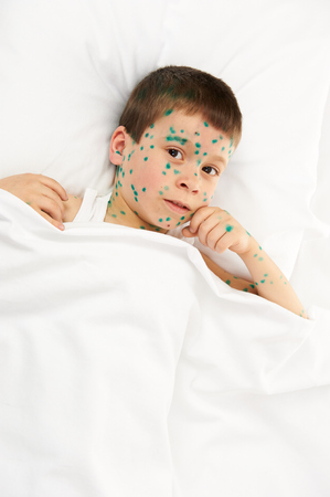 child has the virus on skin, white backgroundの写真素材