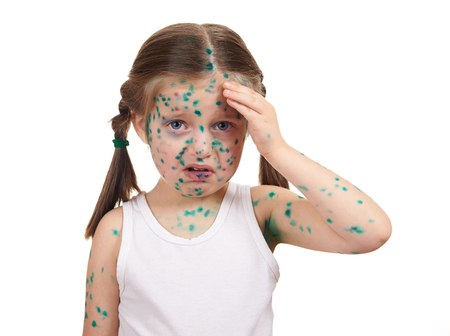 child has the virus on skin, white background