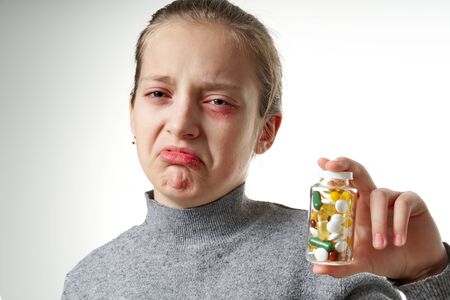 Allergic reaction, skin rash, close view portrait of a girl's face. Redness and inflammation of the skin in the eyes and lips. Immune system disease. Bottle of tablets and pills in child hand.の写真素材