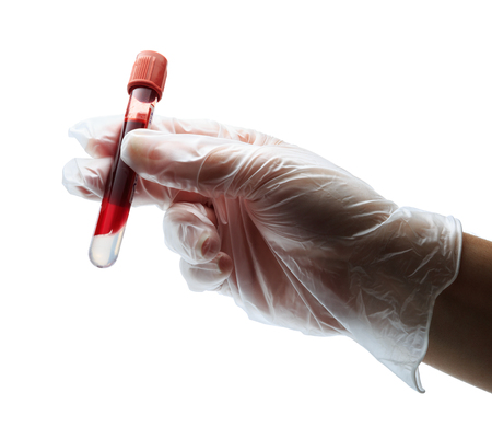 hand with glove holding blood in test tube の写真素材