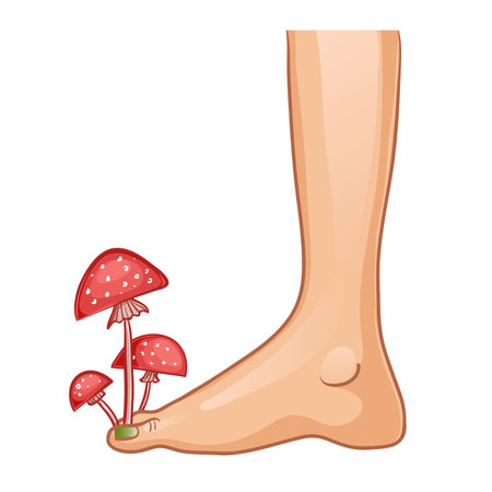 Foot with fungal infection, concept illustration with growing mushrooms, vector image, eps10のイラスト素材
