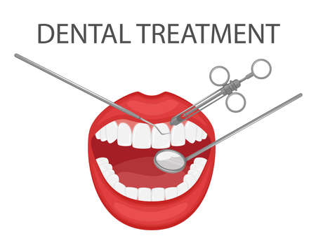 Dental examination and treatment of teeth with a mirror and tools. Professional preventive dental appointment. An open mouth with white teeth. Dental and oral care. Isolated flat vector illustration.のイラスト素材