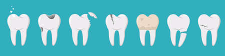 A set of human teeth with different injuries. Healthy and diseased tooth, caries, broken root, plaque, spots, crack. Banner, poster for printing. Infographics in dentistry. Vector. Flat styleのイラスト素材