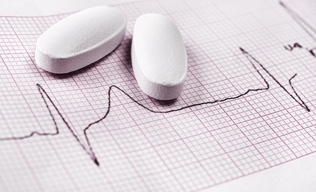Cardiogram test with pillsの写真素材
