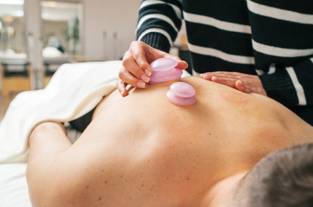 Therapist's hands performing vacuum cupping therapy treatment on female patient's skin. Image highlights relaxation and alternative medicine healthcare practices in traditional oriental clinic.の写真素材