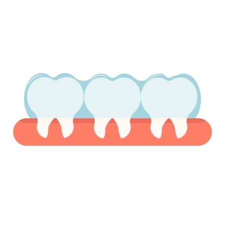 Invisible braces for oral teeth correction. Orthodontic, stomatology concept stock vector illustration. Equipment, object with teth and gum isolated on white background.のイラスト素材