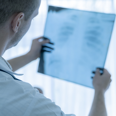 Doctor checking the patient's X-ray. To analyze the disease