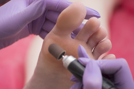 Foot skin treatment process. Gloved hands with a pedicure machine. Close-upの写真素材