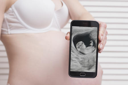 Pregnant woman in underwear holding and showing smartphone with fetal ultrasound photo on white...