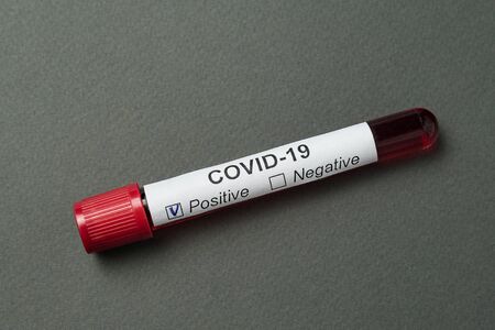 Coronavirus blood test on grey background. Positive test result Covid-19