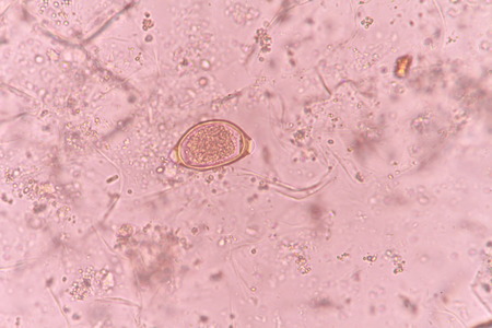 trichuris trichiura