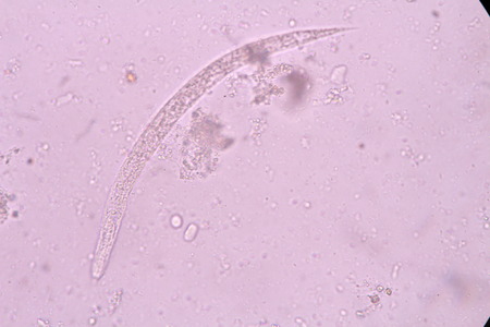 Strongyloides stercoralis