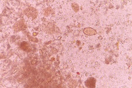 Opisthorchis viverini