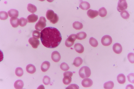 blast cellsの写真素材