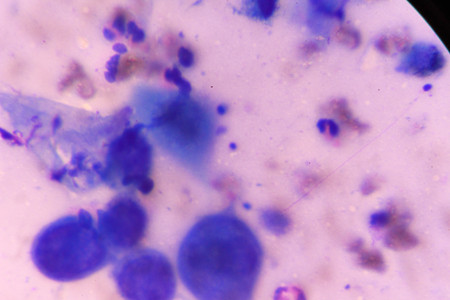 multinucleated giantの写真素材