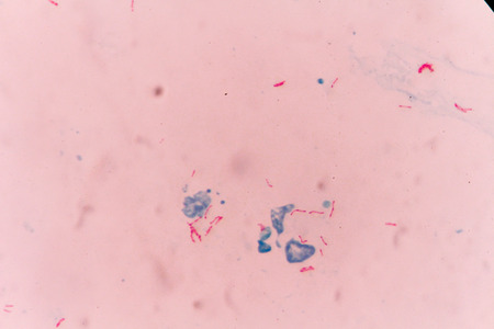 Mycobacterium tuberculosis undermicroscope