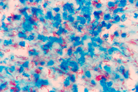 Mycobacterium tuberculosis undermicroscopeの写真素材