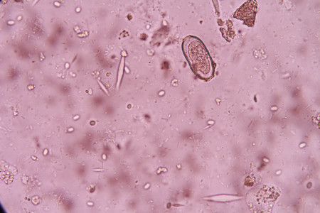 Capillaria philippinensis egg under light microscopyの写真素材