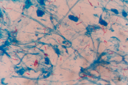 mycobacterium tuberculosis gram-negative  bacteriaの写真素材