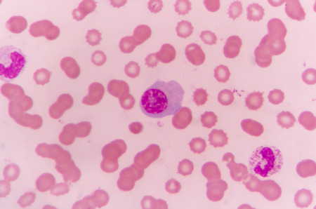 B Cells Lymphocytes Or White Blood Cells Attack Bacteria Inside