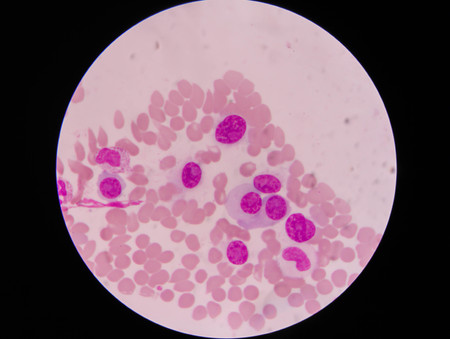 slide blood smear show plasma cell for complete blood countの写真素材