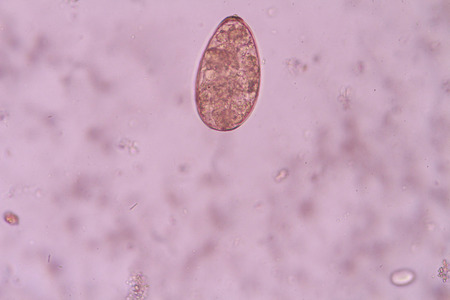 Paragonimus westermani