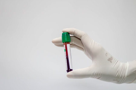 Hand holding test tube with blood plasma ready for testingの写真素材